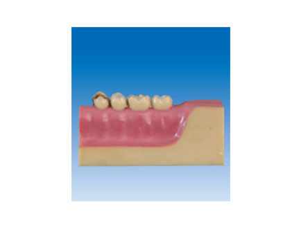 ZM2068 牙齒病理模型